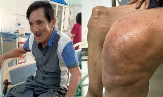 Tình trạng sức khỏe của Thương Tín phải nhập viện. Ảnh: Tô Hiếu.