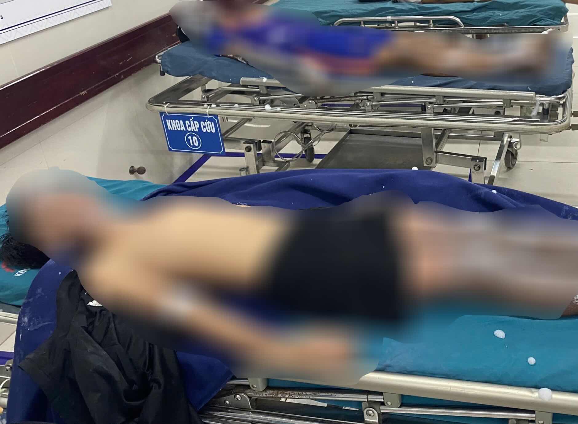 Teenagers suffered severe burns after making homemade fireworks. Photo: Vietnam - Cuba Friendship Hospital Dong Hoi