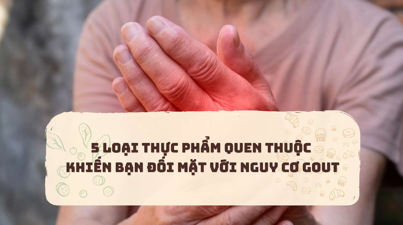 Here are 5 common foods that cause high uric acid.