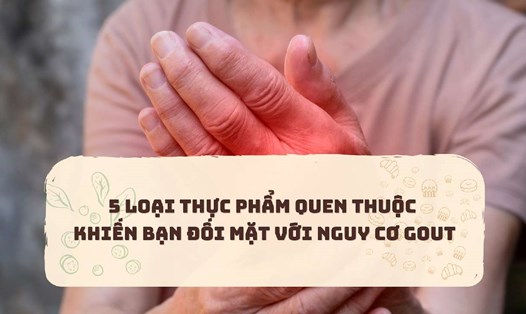 Mách bạn 5 thực phẩm quen thuộc gây axit uric cao.