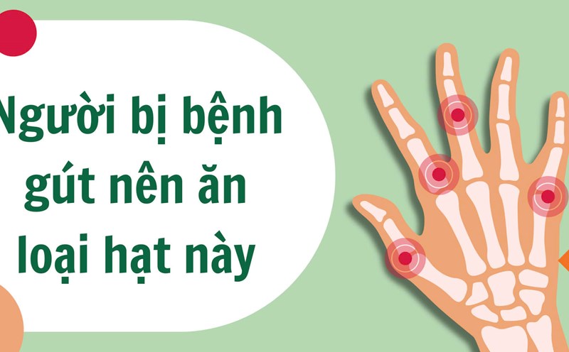 People with gout should eat this type of nut