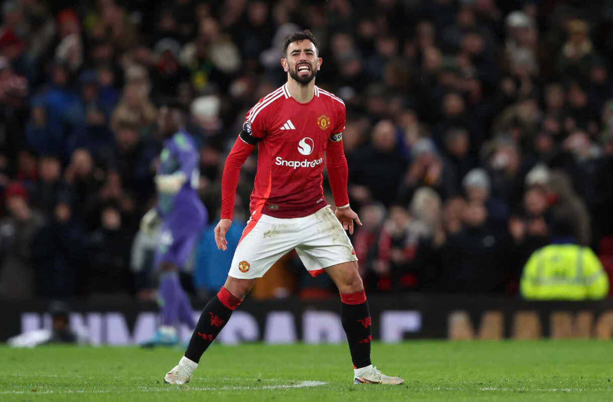 Su bat luc cua Bruno Fernandes.  Anh: MUFC