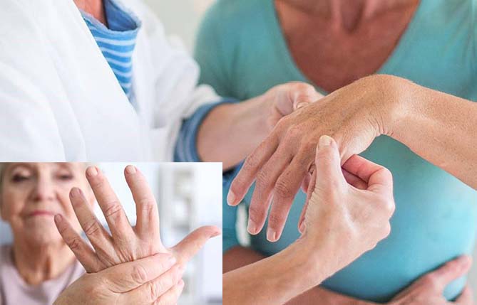 Rheumatoid arthritis is more likely to get worse in winter. Graphics: Ngoc Thuy