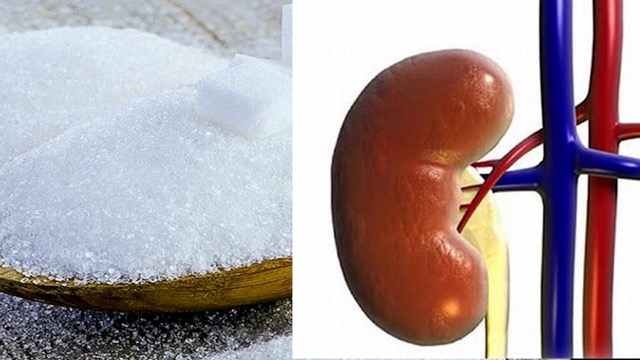 Ăn quá nhiều đường ảnh hưởng nặng nề đến thận. Ảnh ghép: HƯƠNG SƠN 