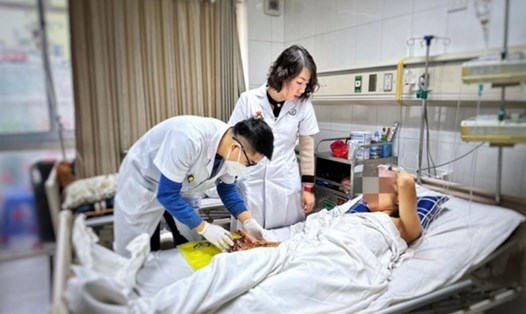 Các bác sĩ Bệnh viện Hữu nghị Việt Đức thăm khám cho bệnh nhân bị giập nát tay do pháo tự chế. Ảnh: Bệnh viện cung cấp