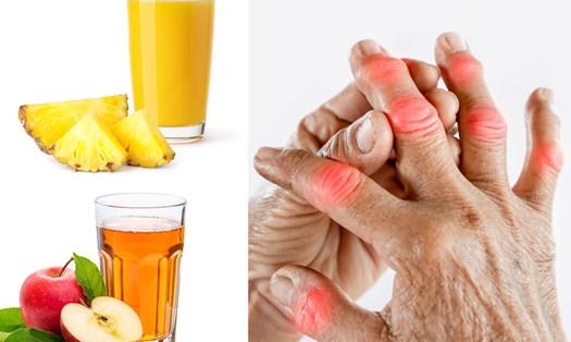 5 loại nước ép loại bỏ axit uric ra khỏi cơ thể, tốt cho người bị gout. 
