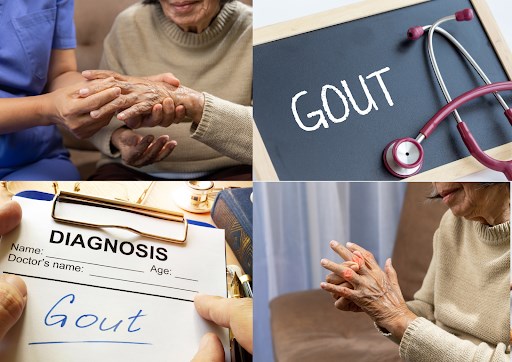 Cách nhận biết từng giai đoạn, diễn biến của bệnh gút
