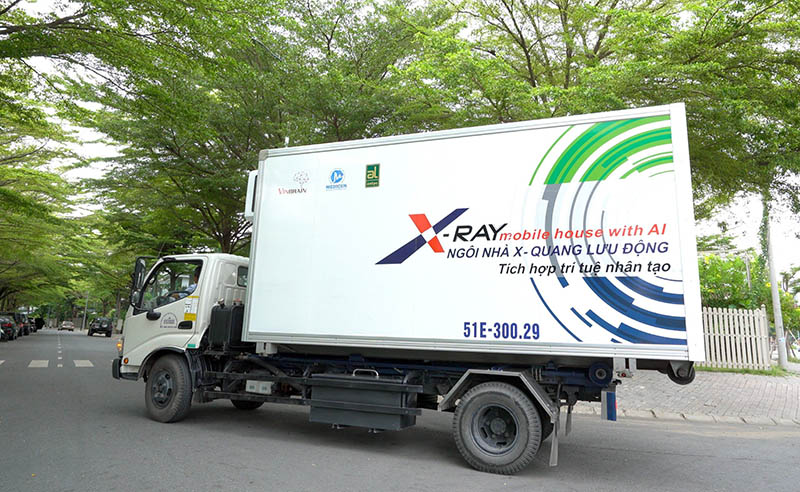 Công nghệ AI của VinBrain được tích hợp trong xe chụp X-quang lưu động giúp tăng cường phát hiện bệnh lao. Ảnh: DN cung cấp