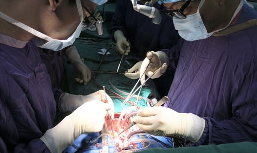 Các bác sĩ thực hiện một ca ghép tạng tại Bệnh viện Hữu nghị Việt Đức. Ảnh: BVCC
