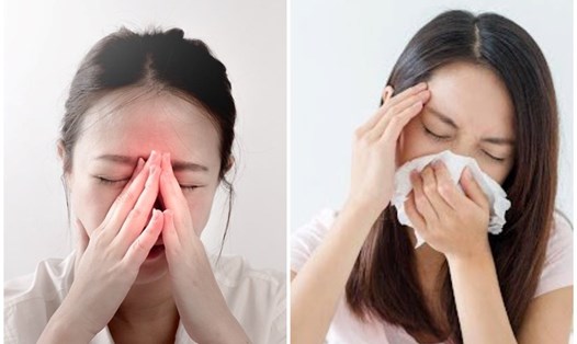 Phương pháp giảm triệu chứng viêm mũi xoang khi thời tiết thay đổi dịp Tết. Đồ họa: Thanh Thanh 