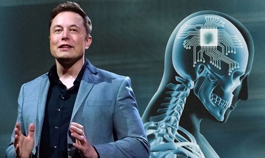 FDA Mỹ đã phát hiện một số vấn đề trong quá trình nghiên cứu trên động vật của Neuralink - công ty chip cấy não của Elon Musk. Ảnh: Chụp màn hình