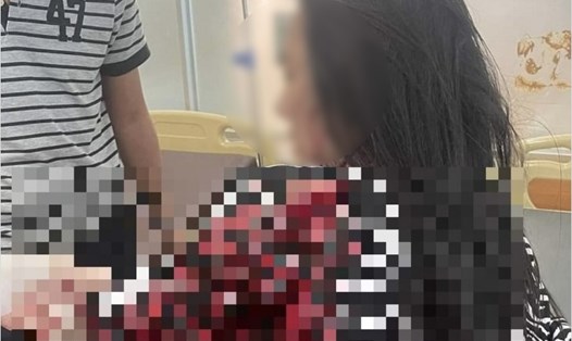 Người phụ nữ bị đối tượng Lê Văn Thiện tấn công điều trị tại bệnh viện. Ảnh: Uy Nguyễn