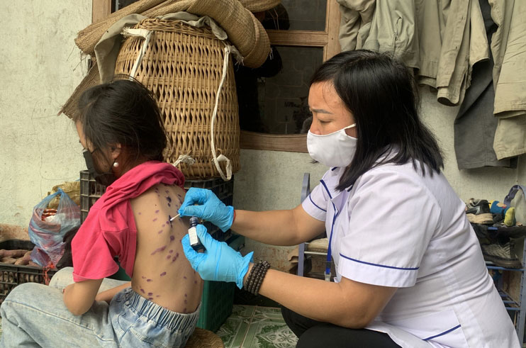 Cán bộ y tế thăm và chăm sóc bệnh nhân thủy đậu tại hộ gia đình. Ảnh: Phương Hiền