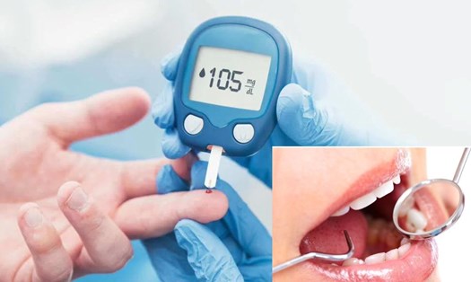 Cách chăm sóc sức khỏe răng miệng ở người bệnh tiểu đường. Đồ họa: Thanh Thanh 