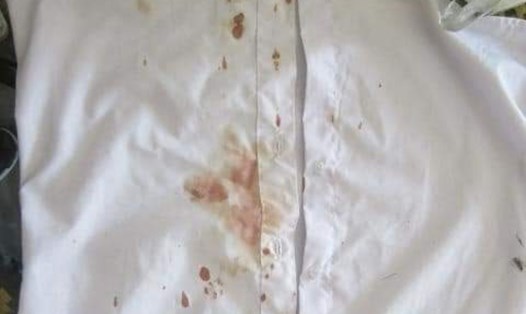 Chiếc áo dính máu được cho là của học sinh sau khi bị đánh. Ảnh: Chụp màn hình