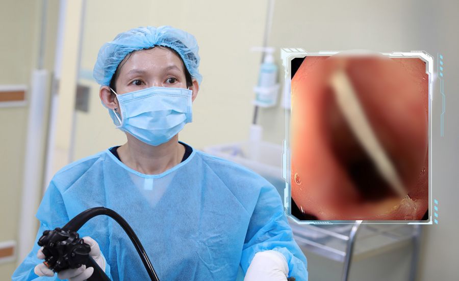 Bênh viện tiếp nhận và điều trị nhiều trường hợp hóc dị vật trong lúc ăn uống, sinh hoạt. Ảnh: Bệnh viện cung cấp