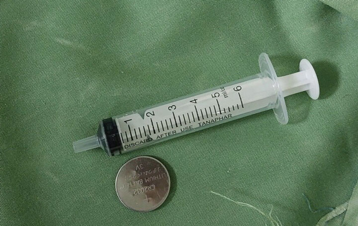 Một trong số rất nhiều dị vật đường tiêu hóa được các bác sĩ gắp ra ngoài. Ảnh: BVCC
