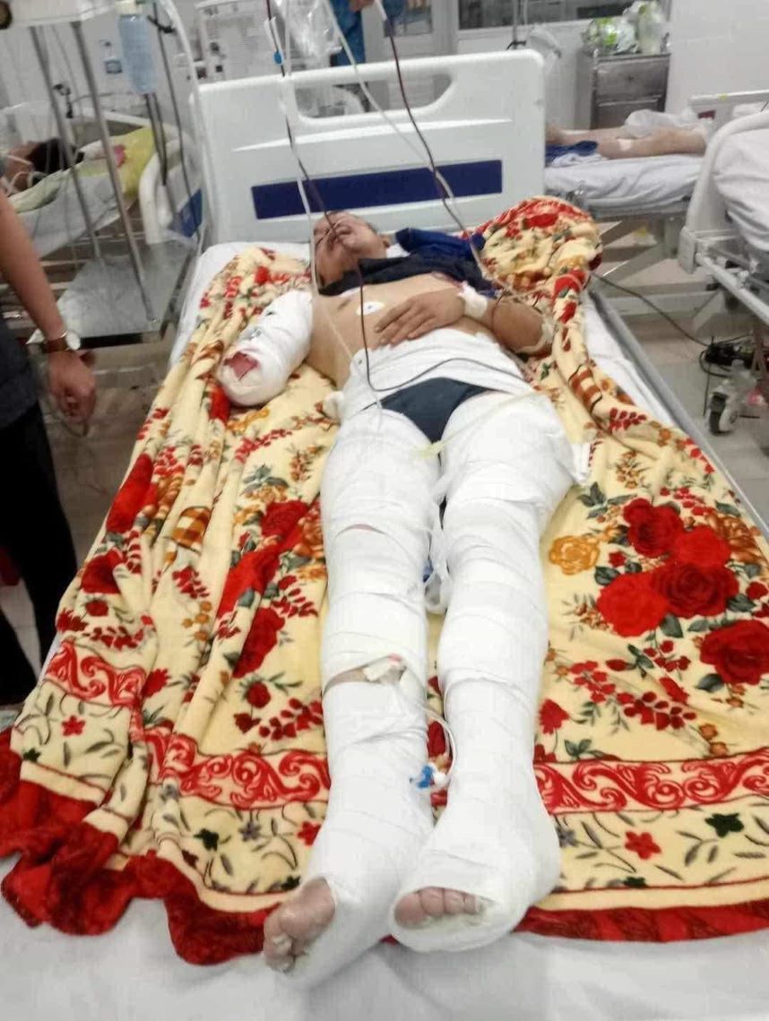 Anh Ab Dol Ro Zak- hướng dẫn viên du lịch đang đang hồi sức cấp cứu tại Bệnh viện Chợ Rẫy, TP Hồ Chí Minh. Ảnh: ATIP
