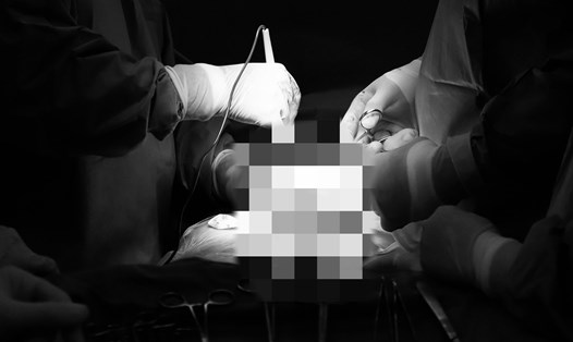 Các bác sĩ thực hiện phẫu thuật bóc khối u. Ảnh: BVQT Phương Châu (Sóc Trăng)
