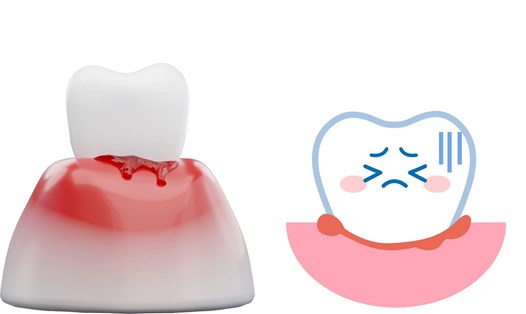 Thay đổi cách đánh răng sẽ giảm nguy cơ chảy máu chân răng. Ảnh ghép: HƯƠNG SƠN