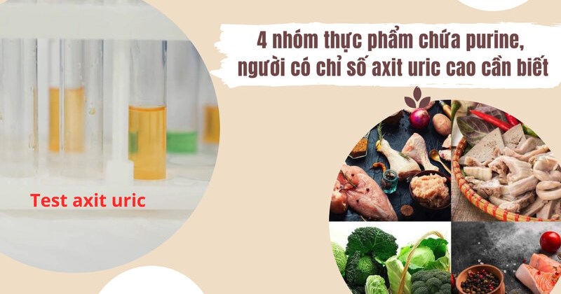 4 nhóm thực phẩm chứa purine, người có chỉ số axit uric cao cần biết