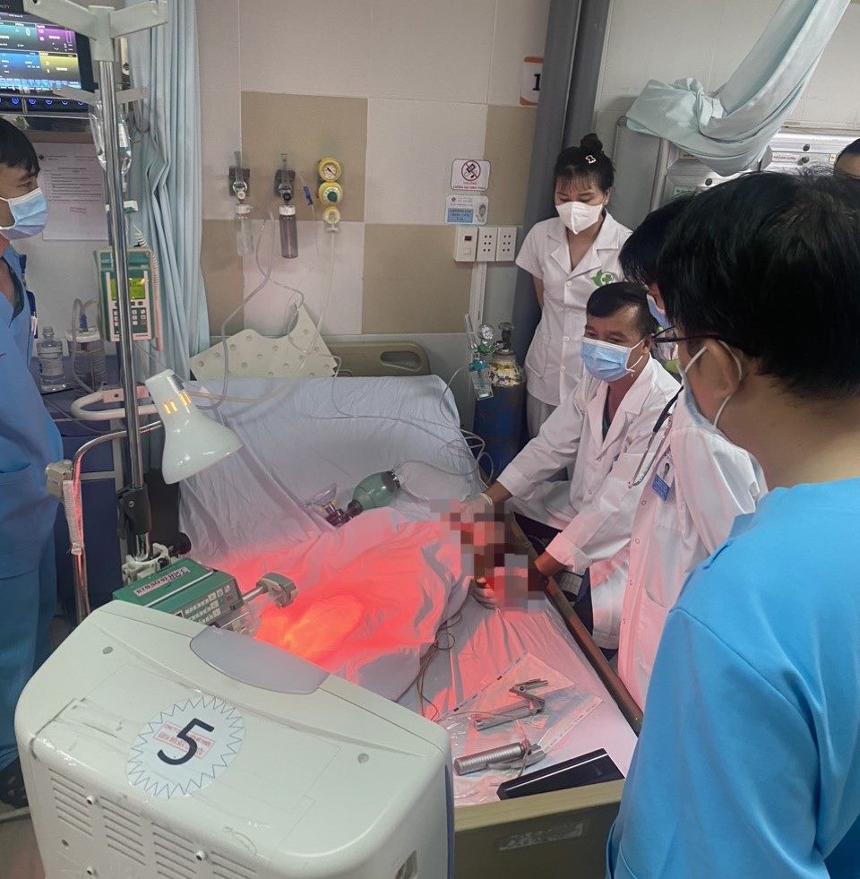 Bé gái bị sốc phản vệ sau tiêm vaccine ở Bến Cát, Bình Dương. Ảnh: Cơ quan chức năng cung cấp