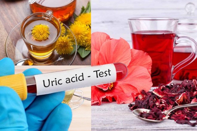 Dâm bụt là một trong những loại trà thảo mộc hỗ trợ giảm axit uric trong cơ thể. Đồ hoạ: Phương Anh