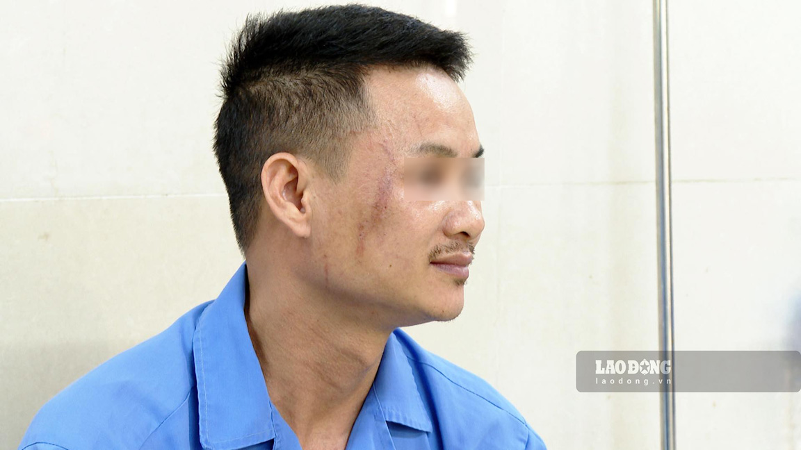 Ninh Bình: Gia tăng số bệnh nhân viêm da tiếp xúc do kiến ba khoang