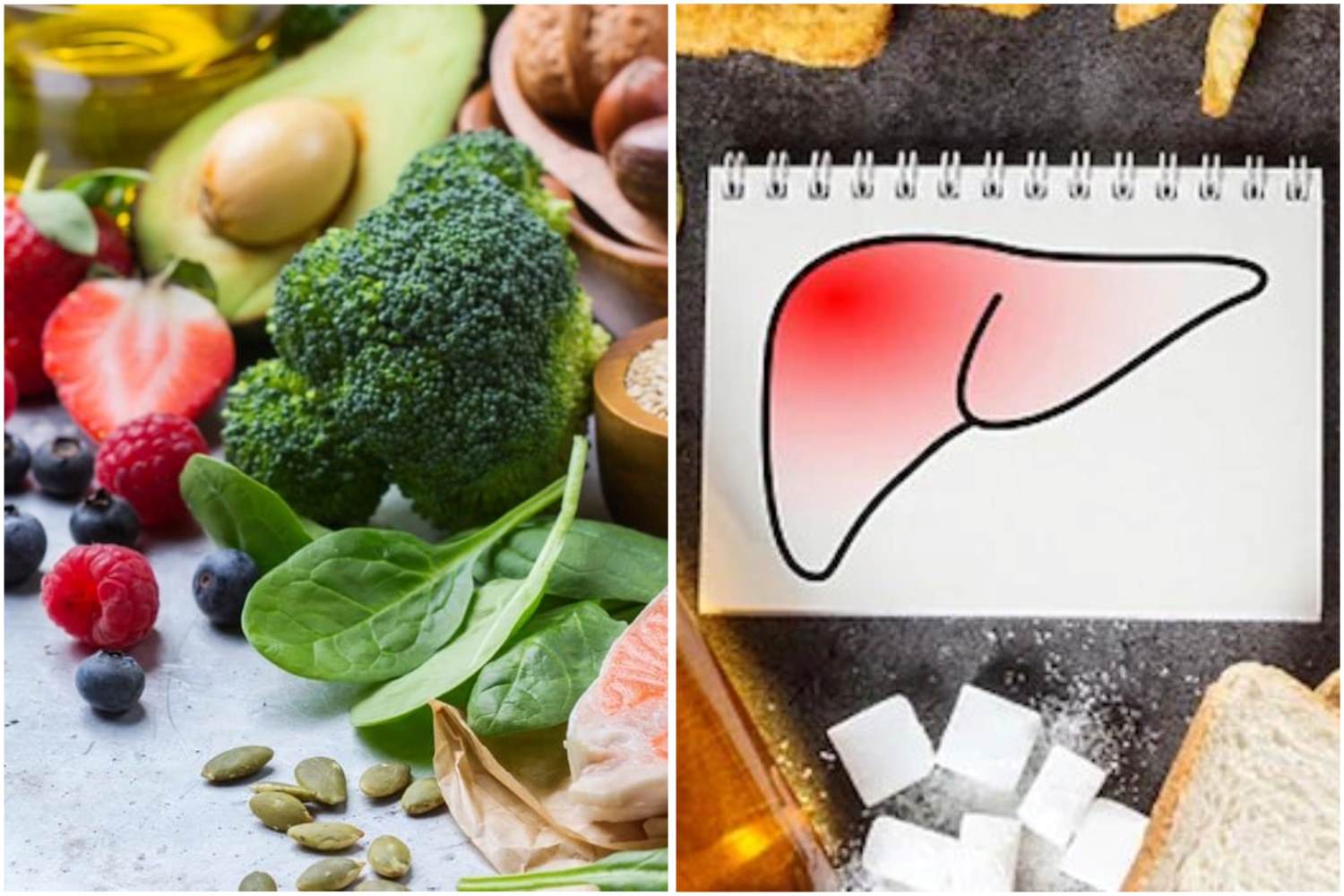 Chế độ ăn uống cho người bị gan nhiễm mỡ. Đồ họa: Thanh Thanh 