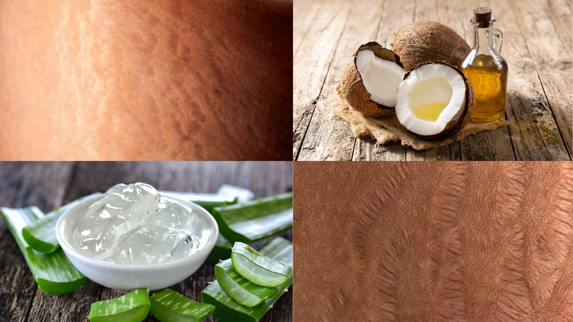 Những nguyên liệu trị rạn da hiệu quả. Đồ họa: Minh Anh