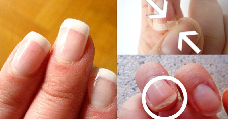 Kiểm tra 7 dấu hiệu này của móng tay để biết tình hình sức khỏe hiện tại