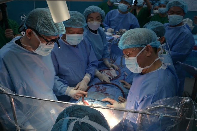 Các bác sĩ Bệnh viện Phổi Trung ương thực hiện ca ghép phổi cho nữ bệnh nhân vào đêm Giao thừa vừa qua. Ảnh: BVCC