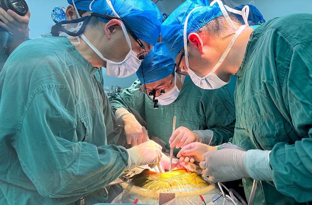 Các bác sĩ phẫu thuật ghép gan lợn cho bệnh nhân nam 71 tuổi vào ngày 17.5.2024. Ảnh: Bệnh viện Đại học Y An Huy