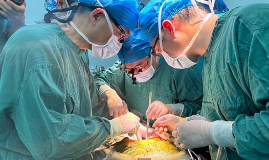 Các bác sĩ phẫu thuật ghép gan lợn cho bệnh nhân nam 71 tuổi vào ngày 17.5.2024. Ảnh: Bệnh viện Đại học Y An Huy
