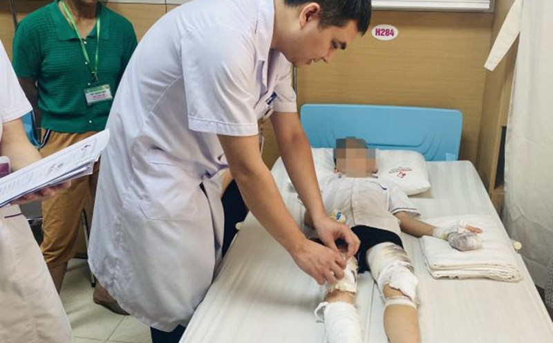 Nhiều trẻ nhập viện do tai nạn thương tích