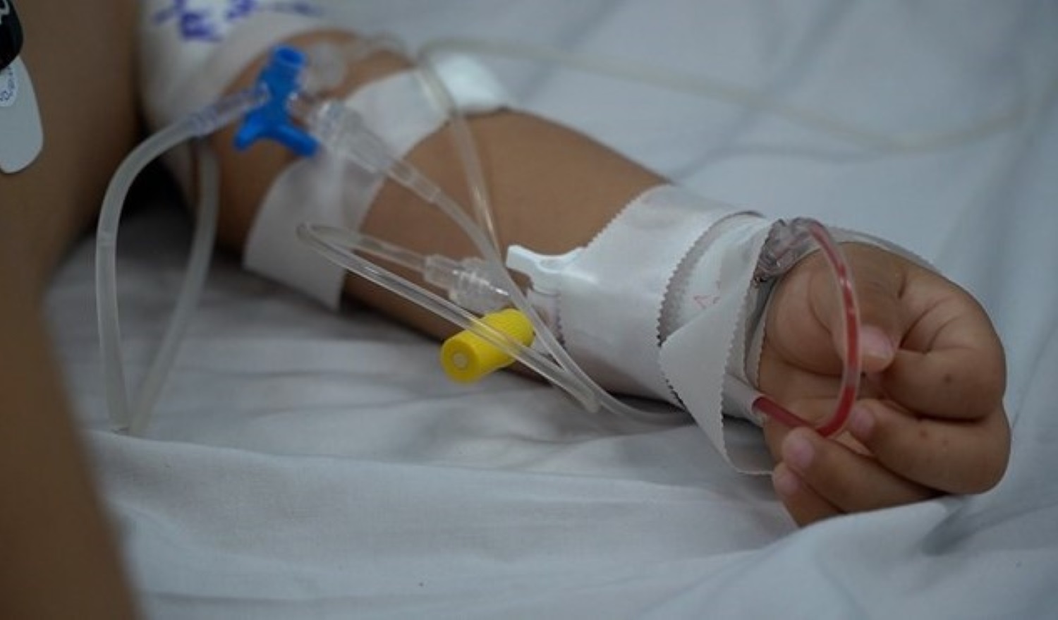 Số ca mắc bệnh tay chân miệng tại TPHCM đang có dấu hiệu gia tăng. Ảnh: Nguyễn Ly