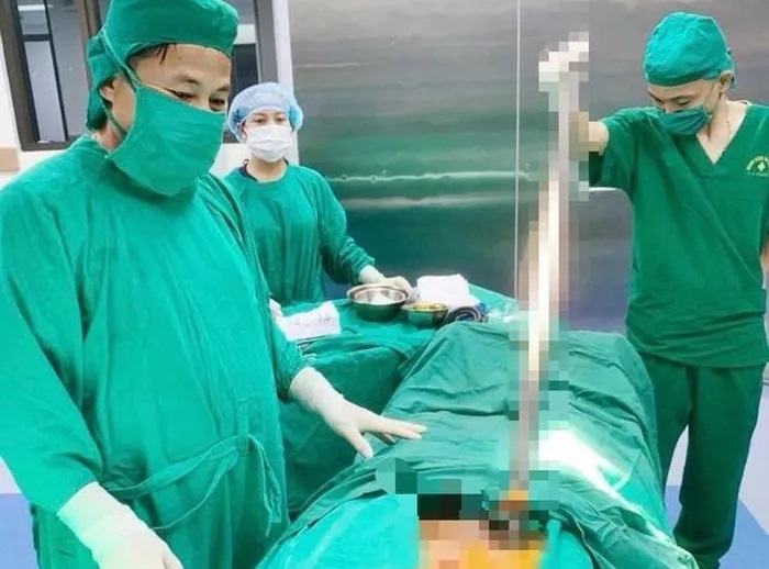 Các bác sĩ Bệnh viện Đa khoa tỉnh Thanh Hóa kịp thời phẫu thuật, cứu sống người đàn ông bị thanh xà beng đâm xuyên cơ thể. Ảnh: Bệnh viện cung cấp
