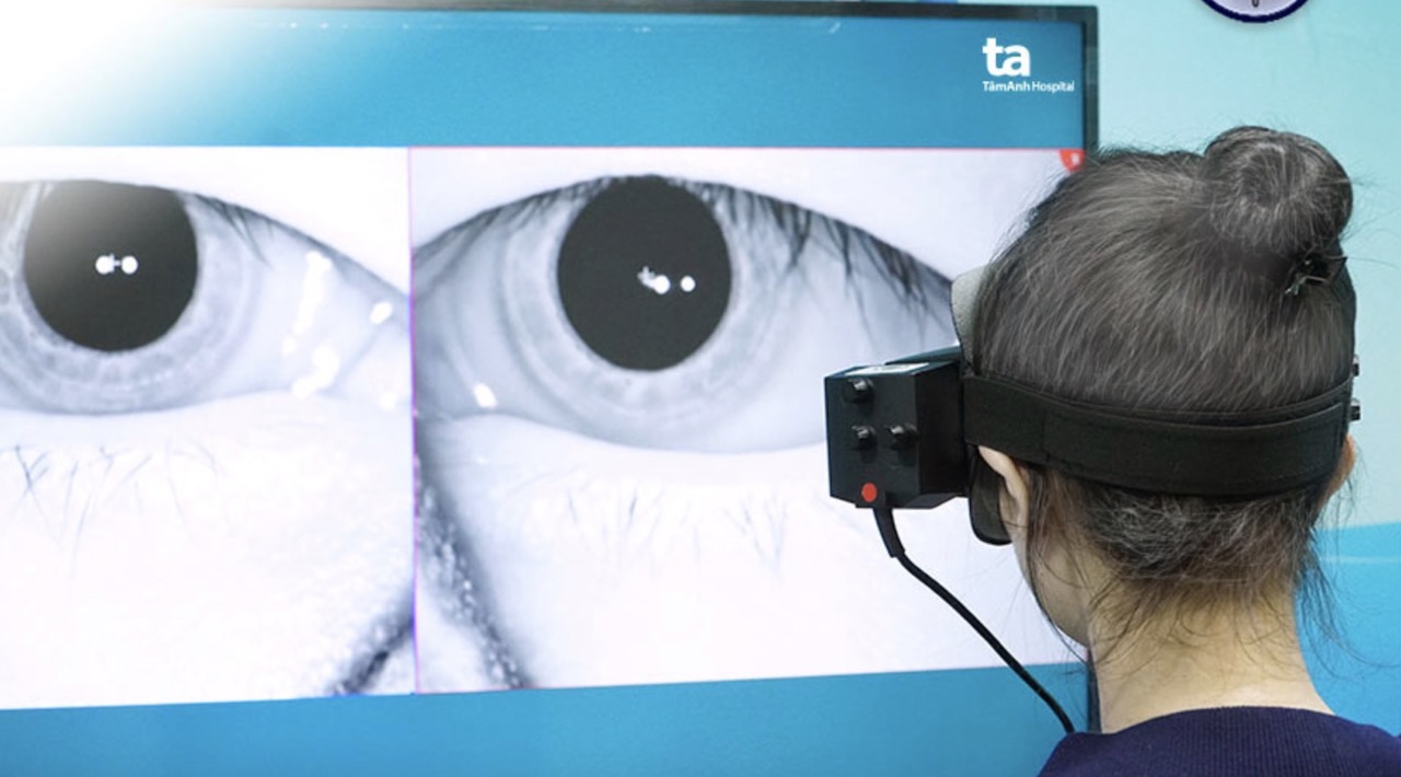 Dùng công nghệ AI chẩn đoán nguyên nhân gây bệnh rối loạn tiền đình.  Ảnh: Phong Lan