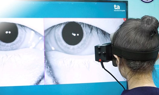 Dùng công nghệ AI chẩn đoán nguyên nhân gây bệnh rối loạn tiền đình.  Ảnh: Phong Lan