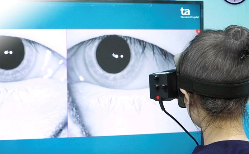 Dùng công nghệ AI chẩn đoán nguyên nhân gây bệnh rối loạn tiền đình.  Ảnh: Phong Lan