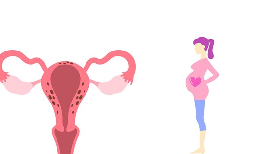 Lạc nội mạc tử cung ảnh hưởng đến chức năng sinh sản. Ảnh ghép: HƯƠNG SƠN 