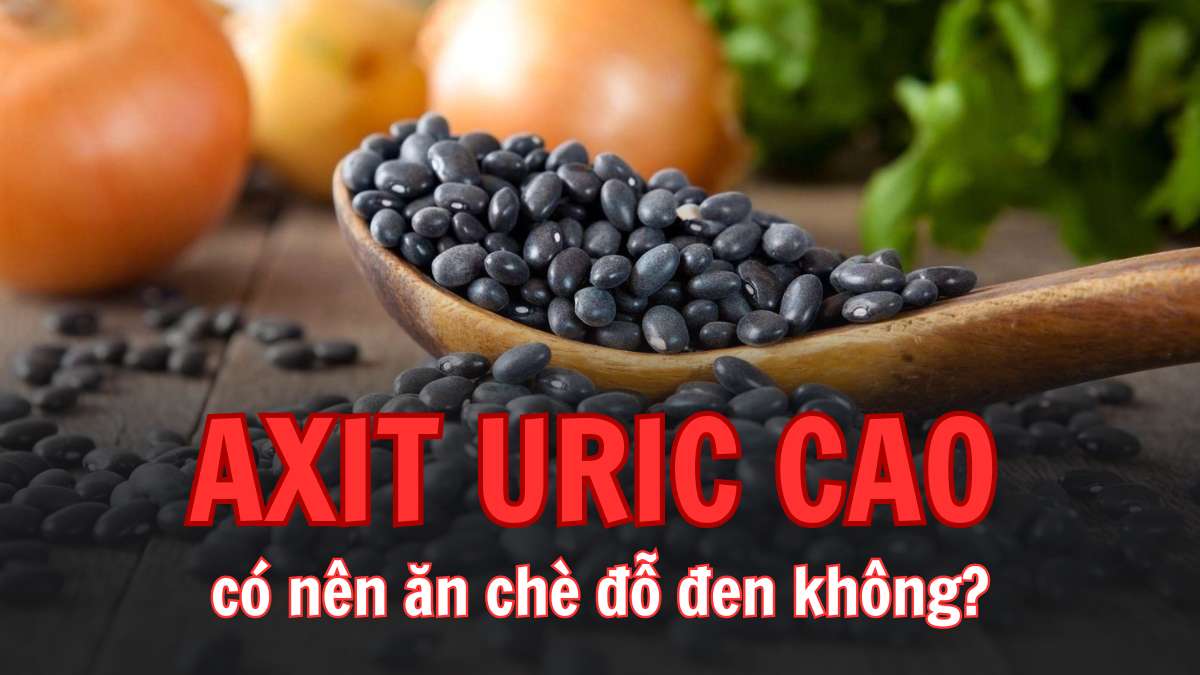 Những người mắc gout hoặc những người có nồng độ axit uric cao nên hạn chế tiêu thụ chè đỗ đen. Đồ hoạ: Thuỳ Dung