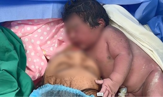 Bé sơ sinh nặng 5,1kg chào đời tại Bệnh viện Phụ sản Hải Phòng cơ sở 2. Ảnh: Bệnh viện Phụ sản Hải Phòng