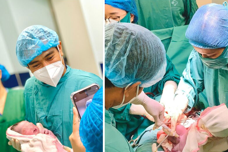 Trong một buổi sáng, có 2 em bé chào đời khi mẹ vẫn còn vòng tránh thai. Ảnh: BV Sản Nhi Phú Thọ