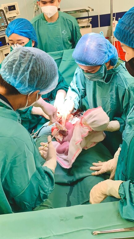 Em bé sinh ra cùng vòng tránh thai của mẹ tại Bệnh viện Sản Nhi tỉnh Phú Thọ. Ảnh: BVCC