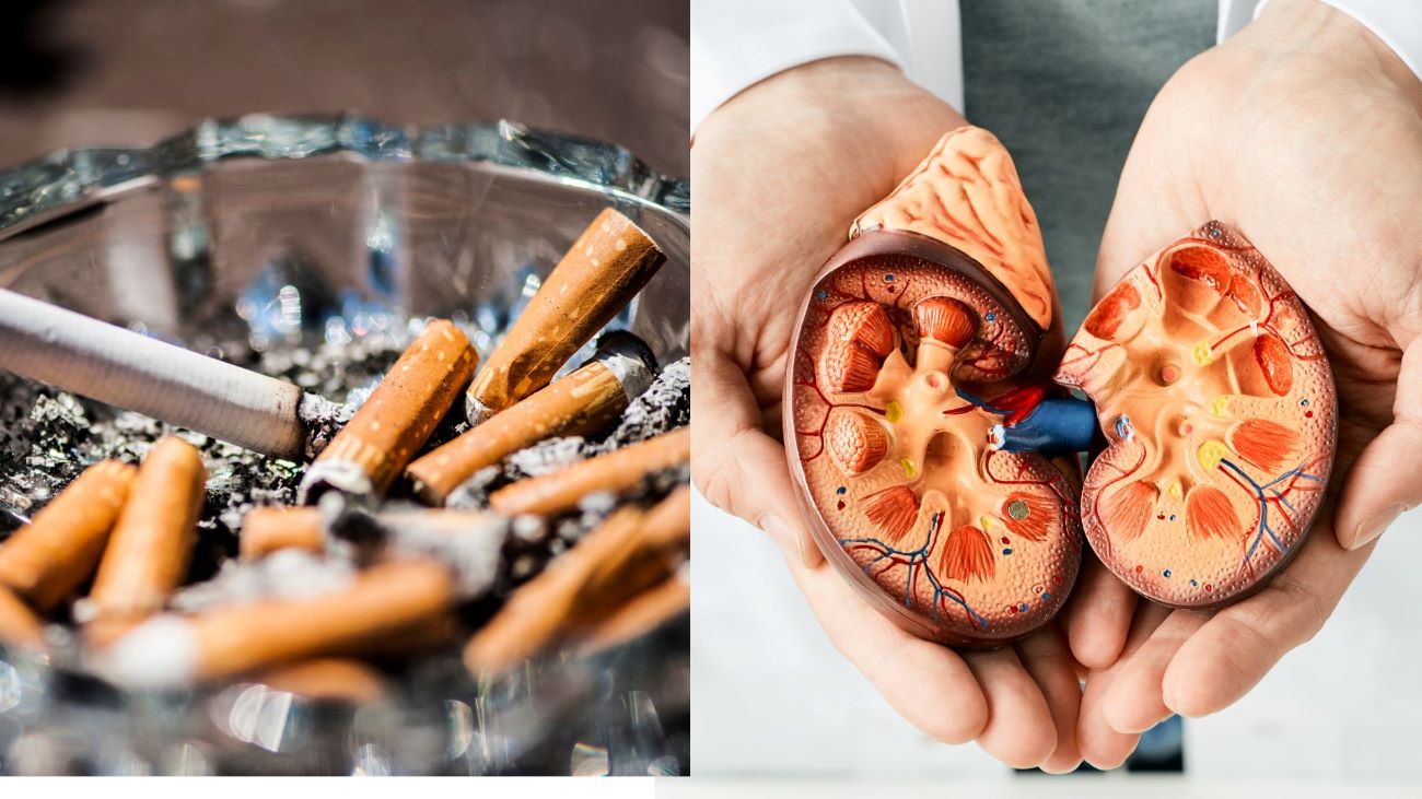 Hút thuốc không chỉ là yếu tố nguy cơ chính gây ung thư thận. Đồ họa: Thanh Thanh 