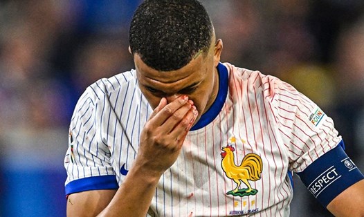 Kylian Mbappe bị chấn thương ở mũi trong trận tuyển Pháp thắng tuyển Áo tại EURO 2024. Ảnh: BR Football