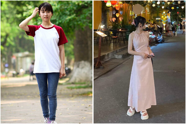 Chị Nguyễn Thị Ngọc Anh trước và sau khi phẫu thuật kéo dài chân thêm 7cm. Ảnh: NVCC.