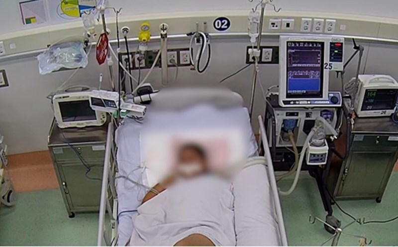 Bệnh nhi được bác sĩ điều trị tích cực tại Bệnh viện Nhi đồng 1. Ảnh: Bác sĩ cung cấp