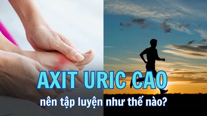 Người axit uric cao và bệnh nhân gout nên tập luyện ra sao?